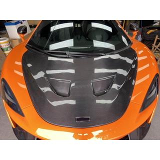Capot (Carbone) McLaren 540C/570S 2015-2020 photo 2